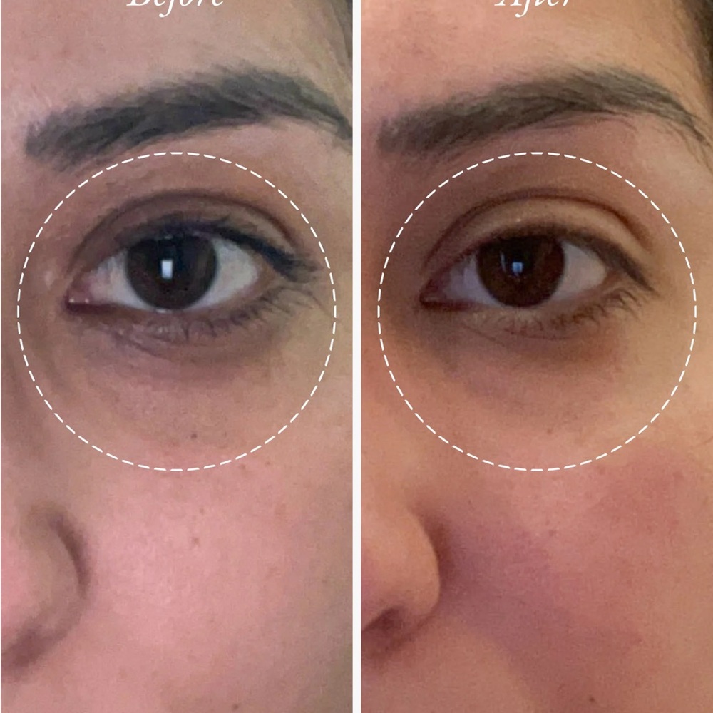 Sahajan golden glow eye balm - Picture 3 of 5